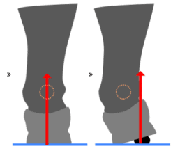 Schematische Darstellung eines Fußes in einem Schuh mit geringem Halt im Fersenbereich; Links: Normalhaltung, Rechts: Umknicken